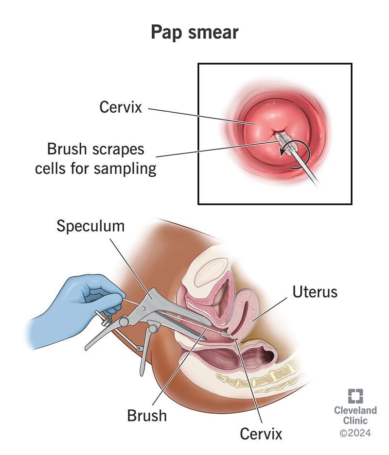 How Often Should You Get a Pap Smear?