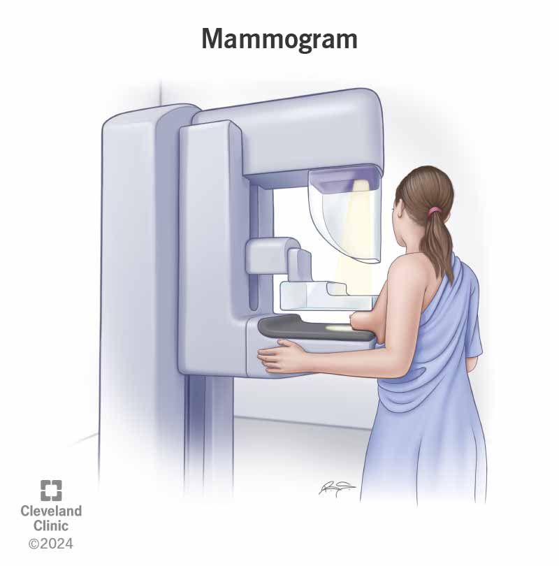 Understanding Mammograms: What to Expect